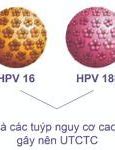 Hpv 18 Là Bệnh Gì